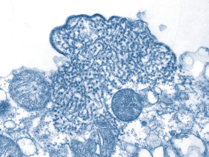 Allarme Globale: Oltre il COVID, la Minaccia Silente dei Patogeni Zoonotici e il Caso Nipah