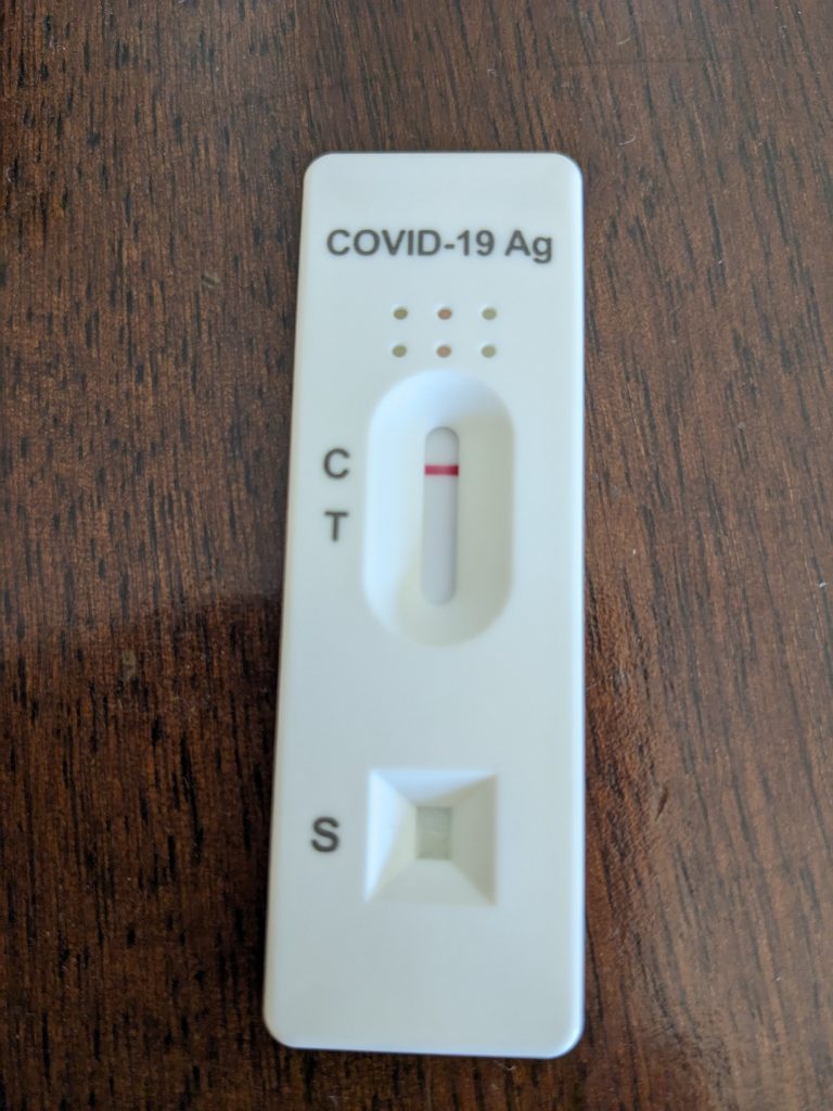 Covid-19: 34 Nuovi Positivi su 870 Test, Prosegue la Sorveglianza Attiva