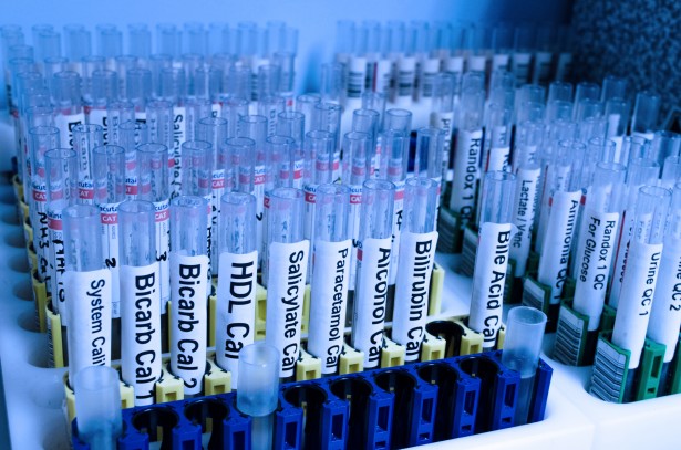 Monitoraggio Covid-19 in Irpinia: 46 Nuove Positività Accertate dall’ASL su 908 Screening